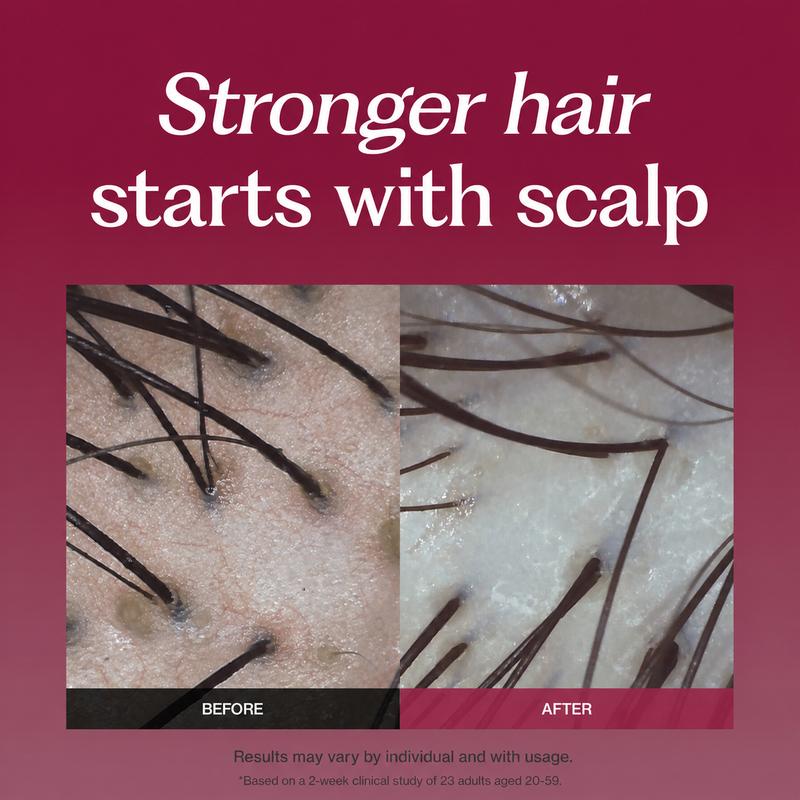 Spider Silk Protein Peptide Shampoo & Treatment Set